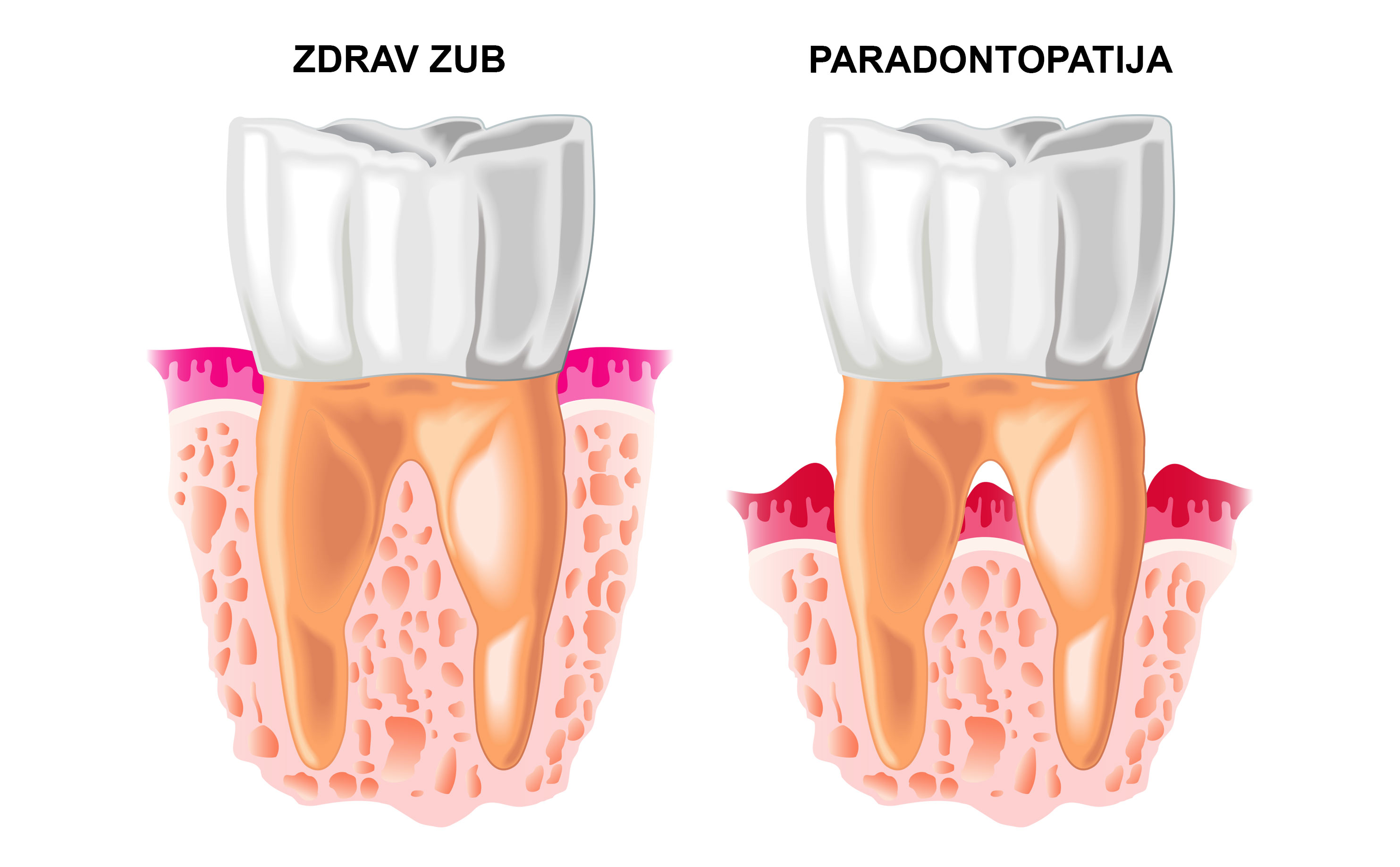 dental-clinic-kovacevic-paradontologija-3